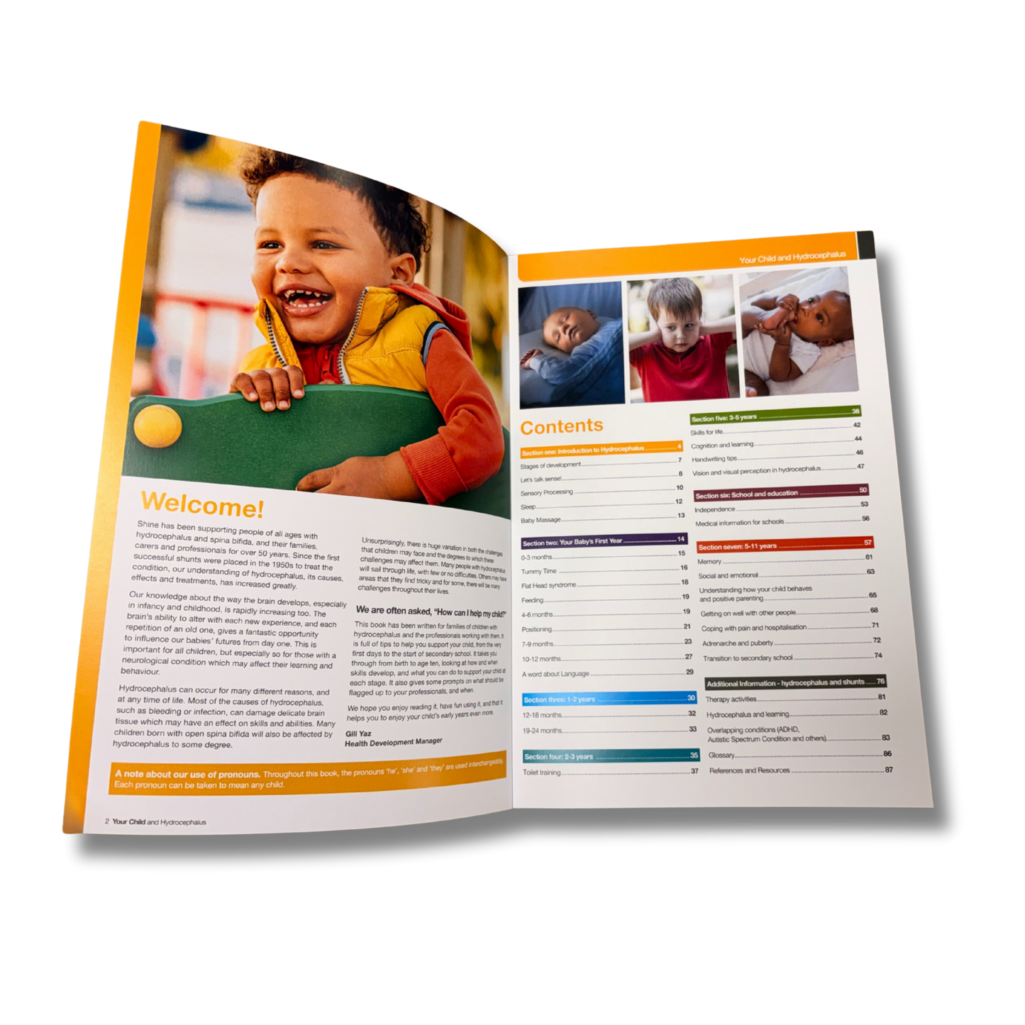 Your Child and Hydrocephalus